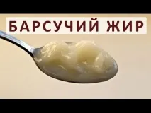 гонартроза стави