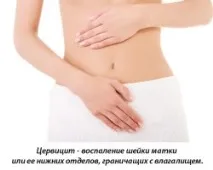 атрофичен шийката матката