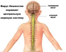 Сказ симптоми, лікування, профілактика профілактика