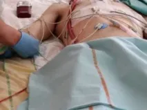 Судово медична експертиза при ДТП, коли призначається, ким проводиться медична