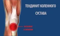 Болять коліна у дитини причини, що робити дитини