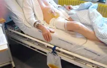 Цистостома, Мій уролог цистостома
