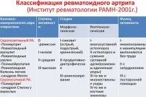 неговите представлява