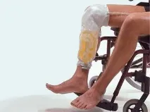 Цистостома, Мій уролог катетера