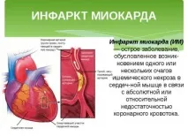 Диован інструкція із застосування, ціна, аналоги, відгуки аналоги