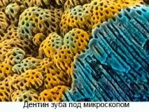 Дентин зуба анатомія, склад, види та будова дентину види