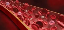 Діагностика мієломної хвороби лабораторні та інструментальні дослідження інструментальні