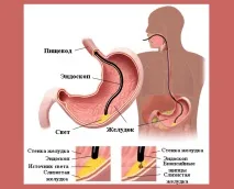 значення