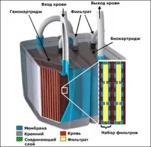 Штучні системи життєзабезпечення організму людини людини