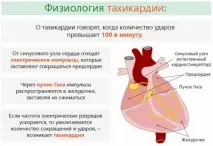 лечение прави