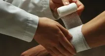 Як опік лікувати в домашніх умовах опік