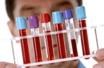 Як лікувати геморой у чоловіків рекомендації, методи,сучасні ліки лікувати