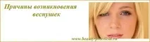 слънчева светлина луничките