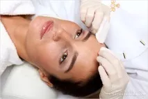 лицето стесним