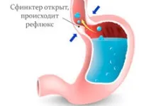 причинява причинява
