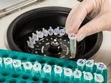 Лікування Кишкової Алергії у 2018 у Дорослих та Дітей, ремісія 89%,Шлунково-кишкова алергія на 2018