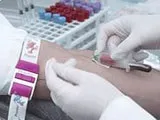 Лікування Кишкової Алергії у 2018 у Дорослих та Дітей, ремісія 89%,Шлунково-кишкова алергія на кишкової