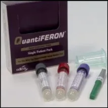 тест quantiferon-tb