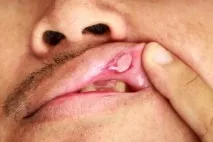 лечение лечение