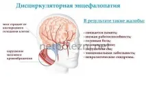 Осередкові зміни речовини мозку дисциркуляторного характеру мозку