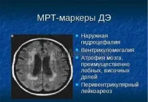 Осередкові зміни речовини мозку дисциркуляторного характеру дисциркуляторного