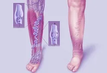 причини