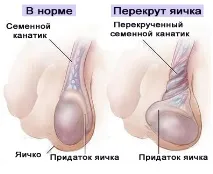 симптоми симптоми