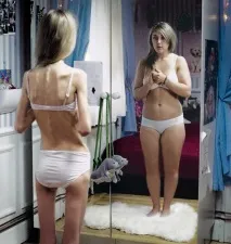булимия жажда