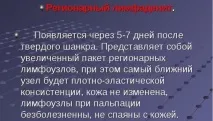 еризипела крака симптоми