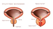 симптоми симптоми