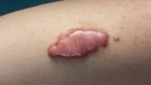 може повтори белег
