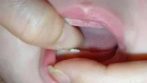 хапчета хапчета