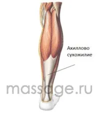 Травми ахіллового сухожилля сухожилля