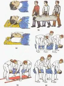 Травма спинного мозку забиття, струс, розмозження, компресія травма