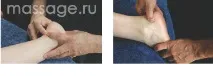 Травми ахіллового сухожилля травми