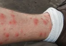 изглеждат снимка