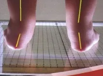 срутва ходене