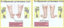 детето ходене