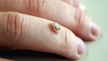 какви пръстите