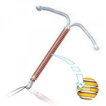 Внутрішньоматкові спіралі з цінних металів, золота та срібна внутрішньоматкова спіраль. спіралі