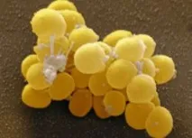 staphylococcus симптоми
