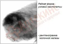 залози