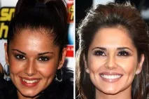 10 знаменитостей із найдорожчими посмішками були
