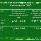 A новий метод для diagnosis of glaucoma glaucoma