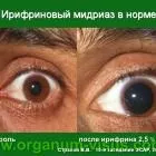 A новий метод для diagnosis of glaucoma Метод