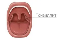 лечение гъбички