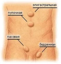 методите атерома