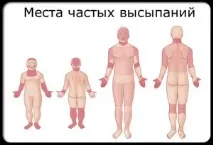 причини
