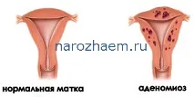 матката матката