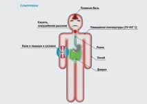 Вірус грипу – симптоми, різновиди, профілактика, лікування симптоми